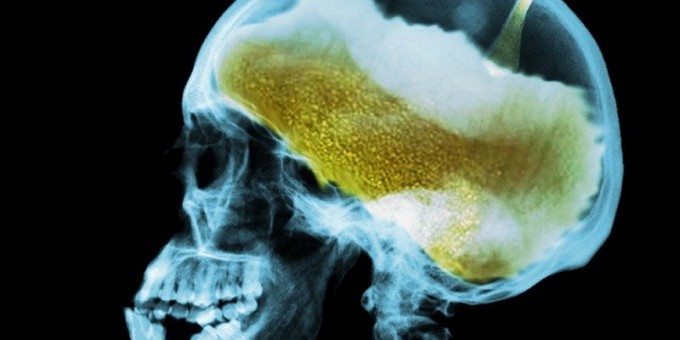 Почему от алкоголя мы пьянеем?